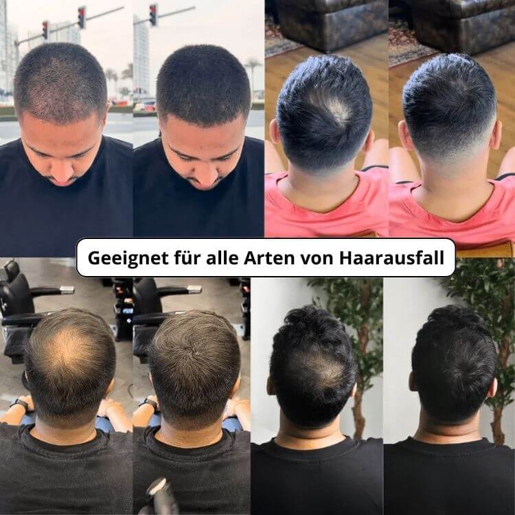 Vollum Haarauffüller