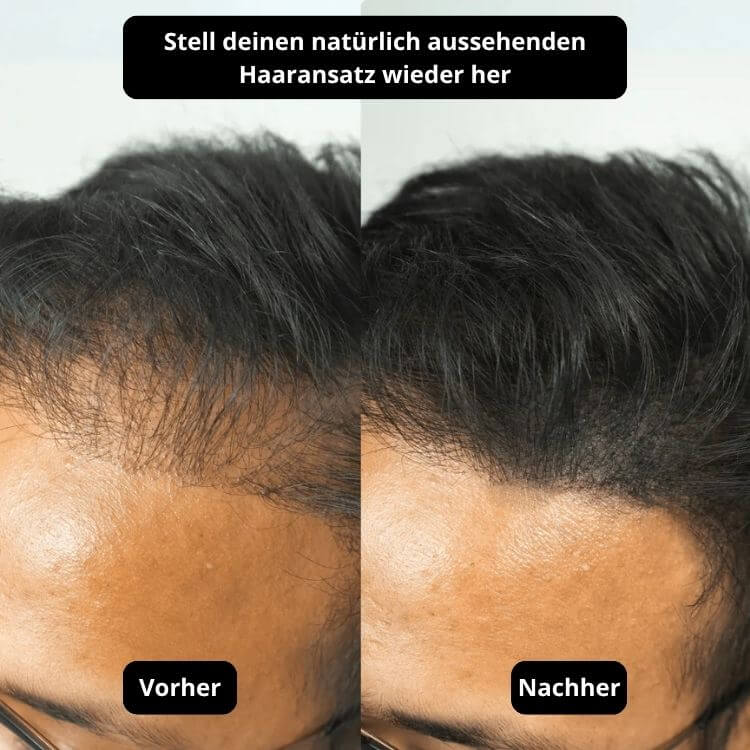 Vollum Haarauffüller