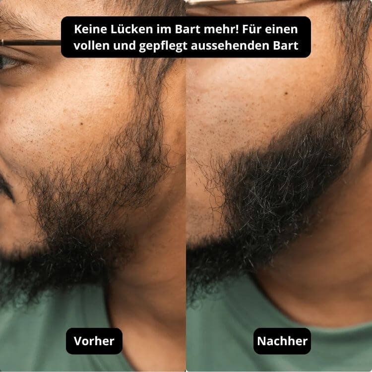 Vollum Haarauffüller