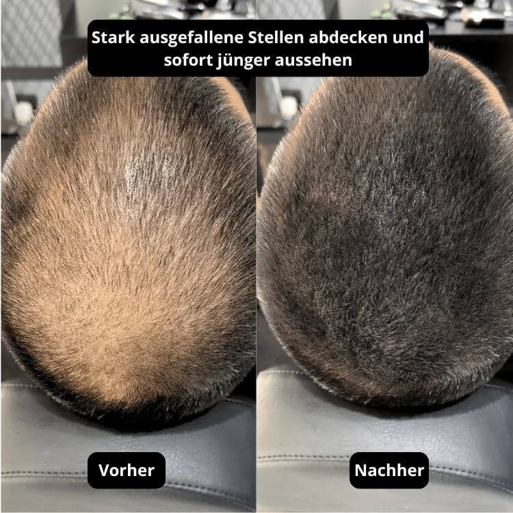 Vollum Haarauffüller